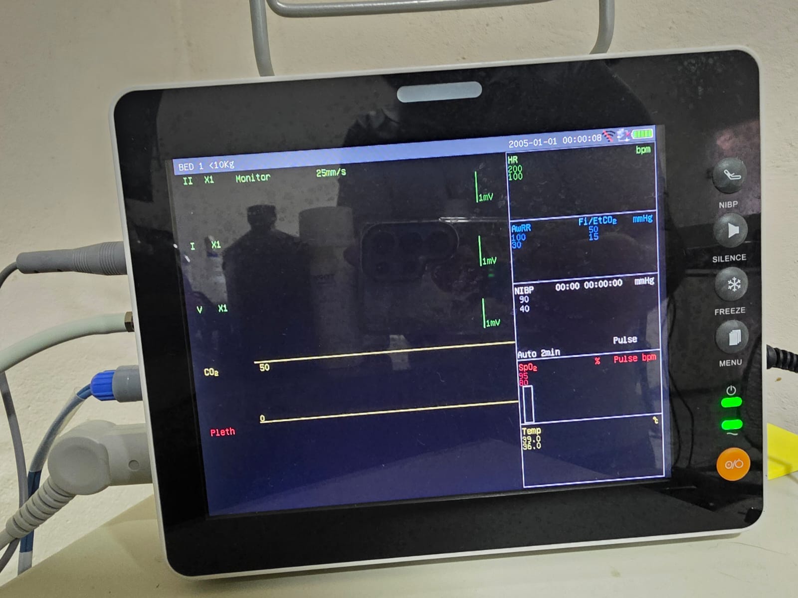 Monitor multiparamétrico para cirugías